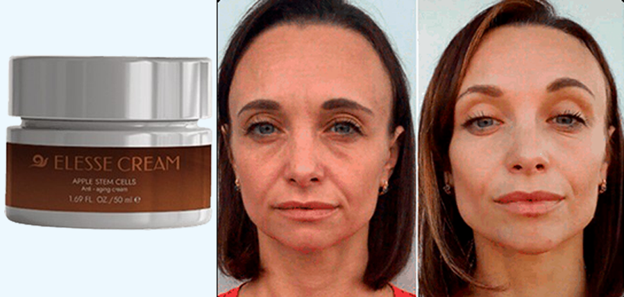 elesse cream cena elesse cream co to jest elesse cream o elesse cream forum elesse cream opinie elesse cream Elesse Cream cena Elesse Cream opinie Elesse Cream fórum Elesse Cream gdzie kupić Elesse Cream zamówienie Elesse Cream apteka Elesse Cream dostawa przy odbiorze Elesse Cream skład Elesse Cream promocja Elesse Cream recenzja Elesse Cream apteka Elesse Cream w aptece Elesse Cream apteka cena Elesse Cream apteka opinie Czy Elesse Cream jest w aptece?